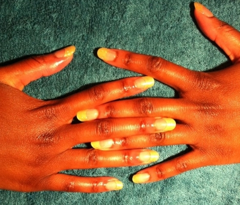 Gel Extensions