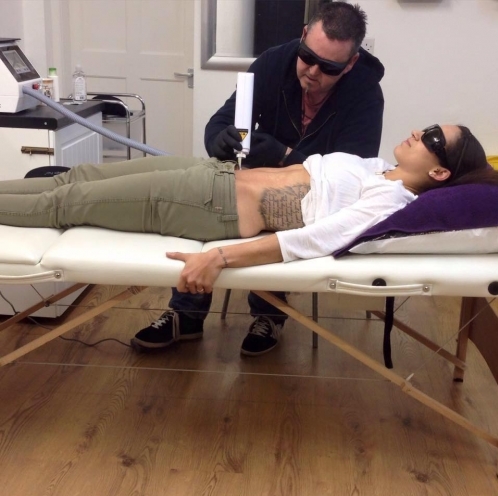 birstall body art tattoo removal in leicester birstall body art tattoo removal in leicester