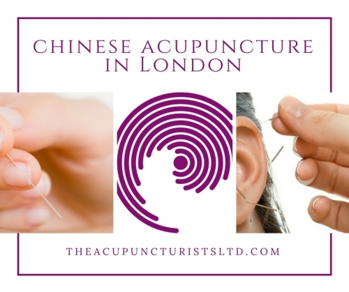 Chinese Acupuncture In London