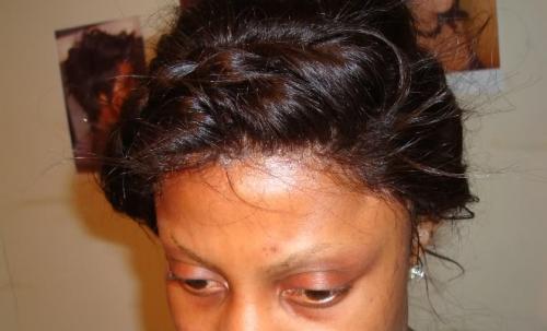 Undetectable hairline for Lace Wigs