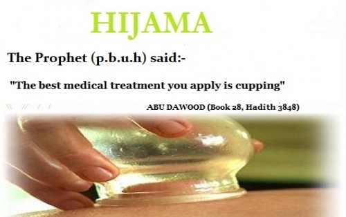 Hijama/Cupping
